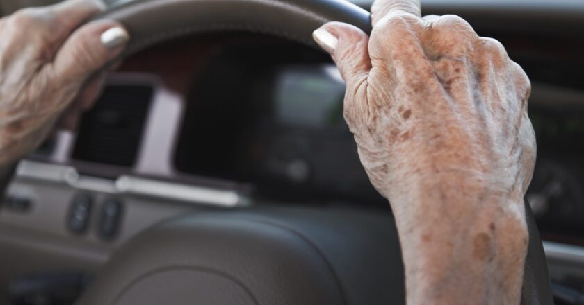 Dementia Underdiagnosis and Driver’s License Laws