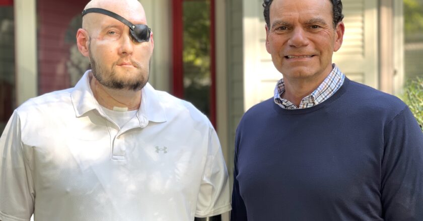 Meet the World’s First Whole-Eye Transplant Recipient