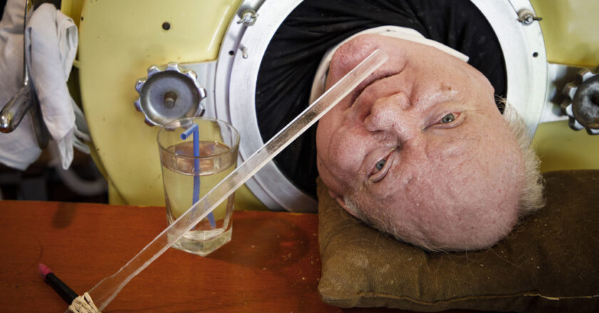 Paul Alexander: Polio Patient With Iron Lung Dies at 78