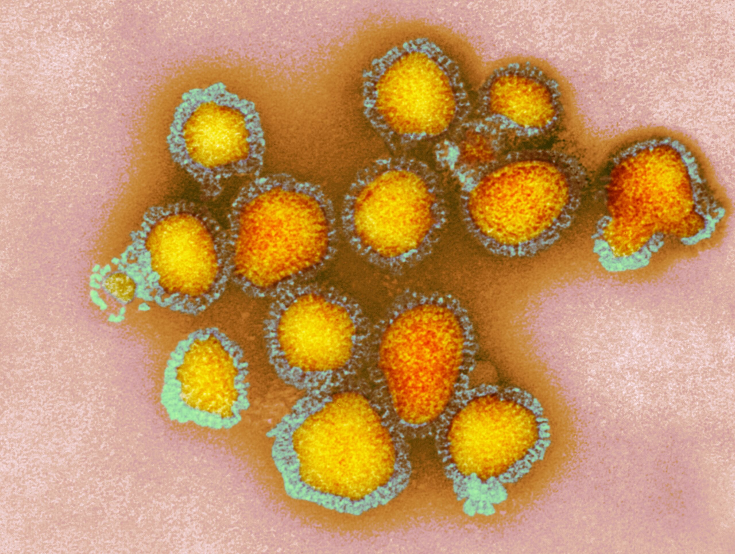 influenza virus scaled