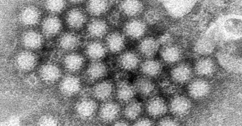 Norovirus Cases Are Rising. Here’s What to Know