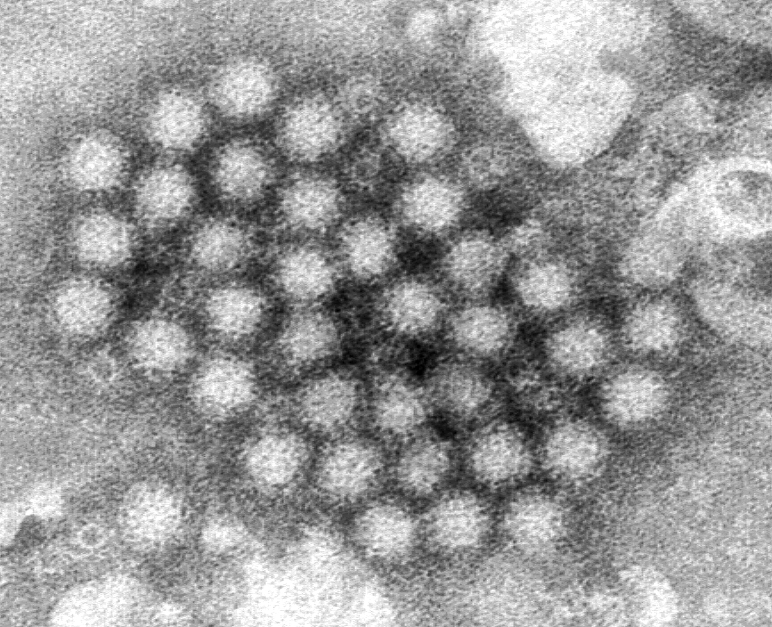 norovirus scaled