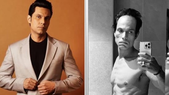 Randeep Hooda underwent physical transformation for his directorial venture Swatantrya Veer Savarkar Randeep Hooda underwent physical transformation for his directorial venture Swatantrya Veer Savarkar