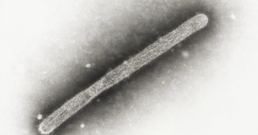 Michigan Dairy Worker Diagnosed With Bird Flu