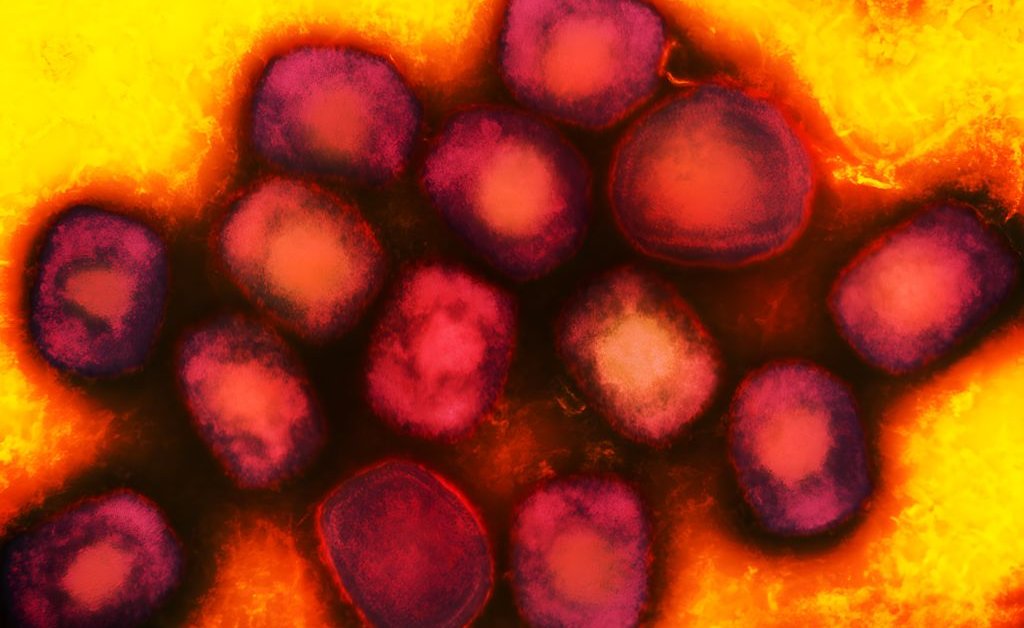 GettyImages 1428289519