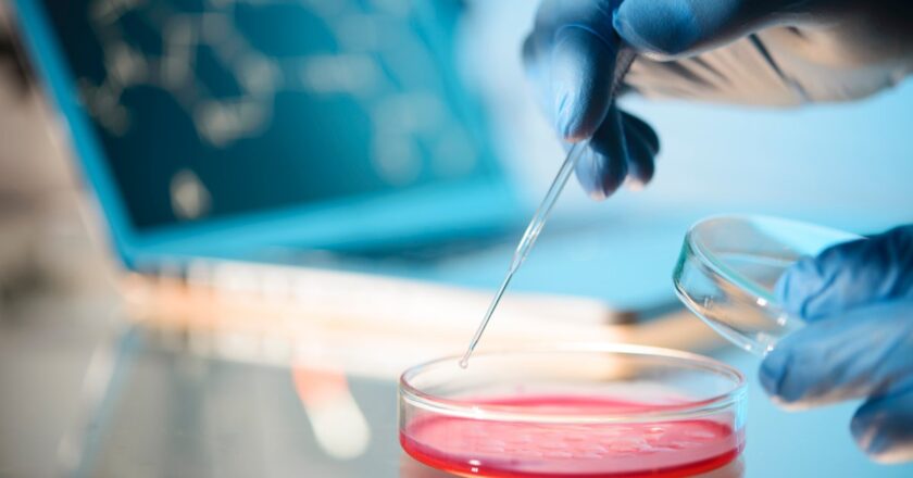 First U.S. Case of Sexually Transmitted Fungal Infection