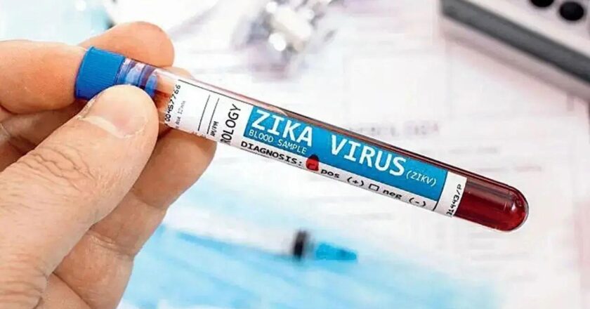 Maternal Zika infection may have long-term effects on babies` immune system