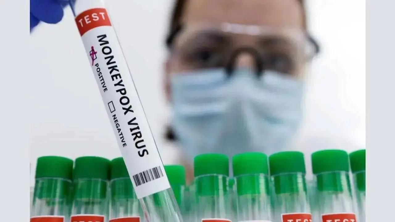 Expert urges health officials to begin screening for Mpox at