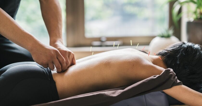 London’s Best Acupuncturists | Evening Standard