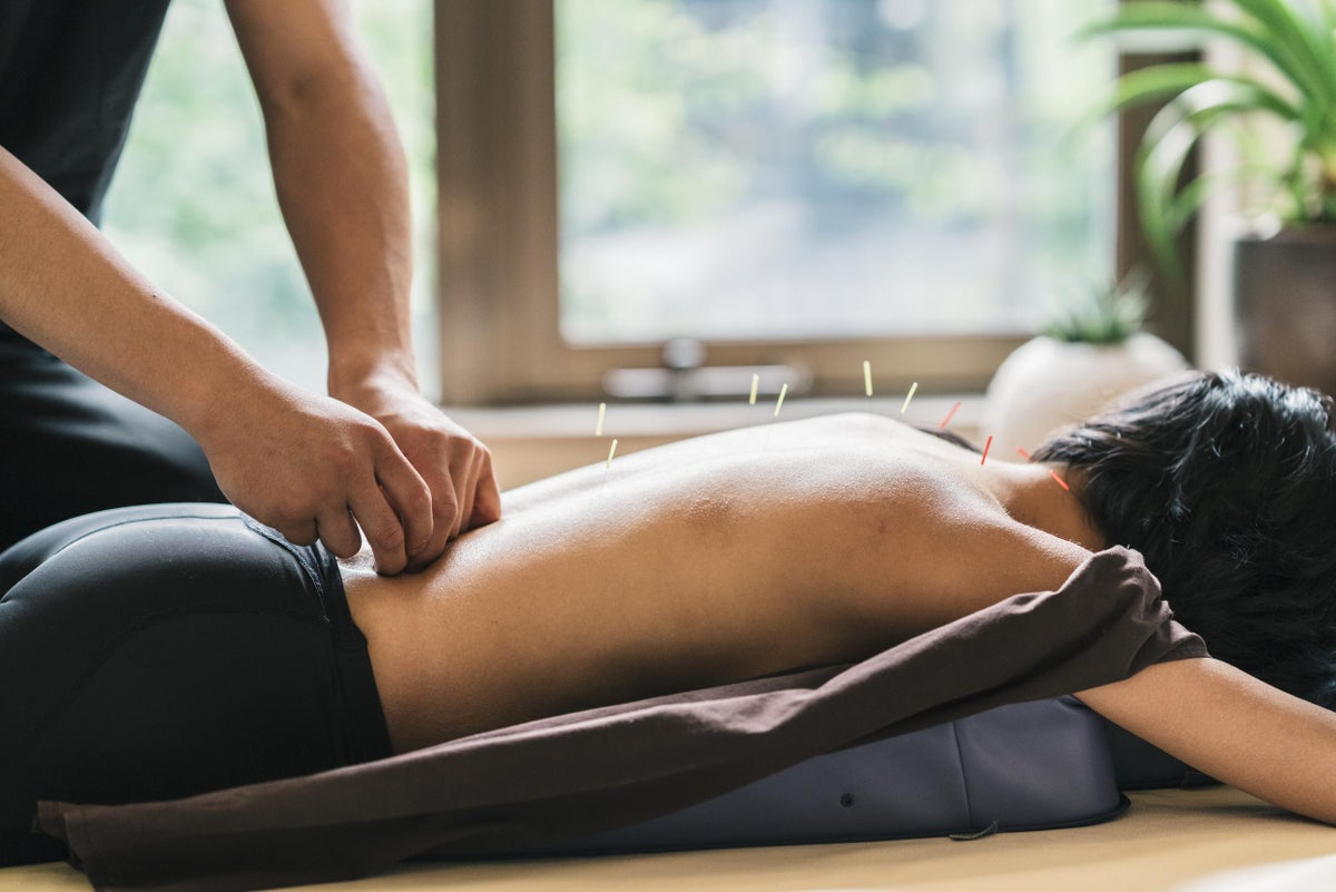 Londons Best Acupuncturists Evening Standard