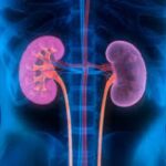 Weight loss surgery can reduce kidney failure risk in diabetics by 44 pc: Study