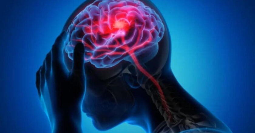 Why women are more at risk of stroke than men