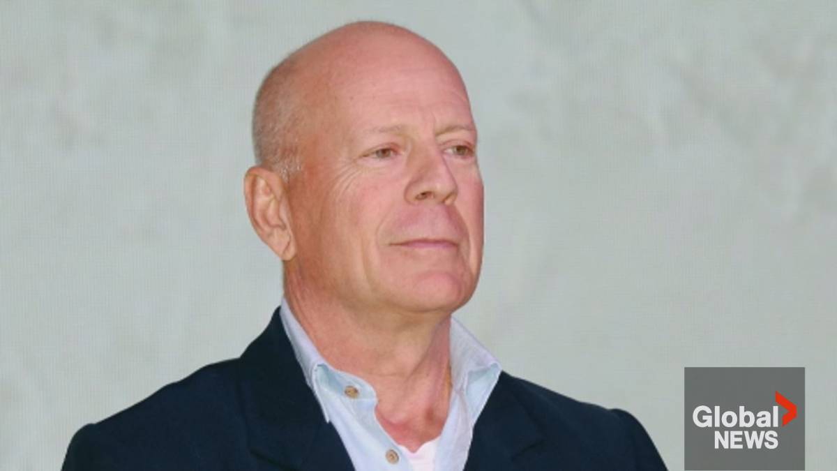 Click to play video: 'Bruce Willis diagnosed with dementia 1 year after battling with aphasia'