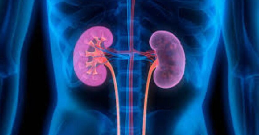 Kidney disease may raise the risk of strokes, say experts