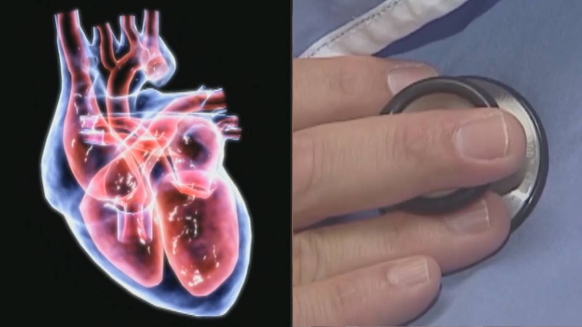 Click to play video: 'Health Matters: Do you know signs of a stroke?'