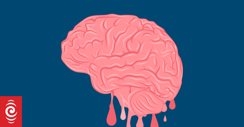 What is Brain Rot, the Oxford Dictionary’s Word of the Year?