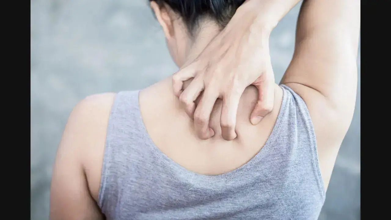 Belly fat may raise risk of psoriasis in women finds