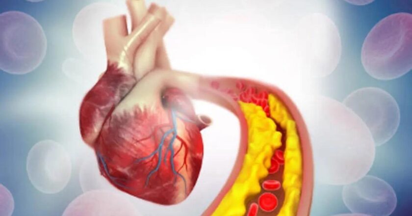 This cholesterol pill may fight high risk of heart attack, stroke: Study