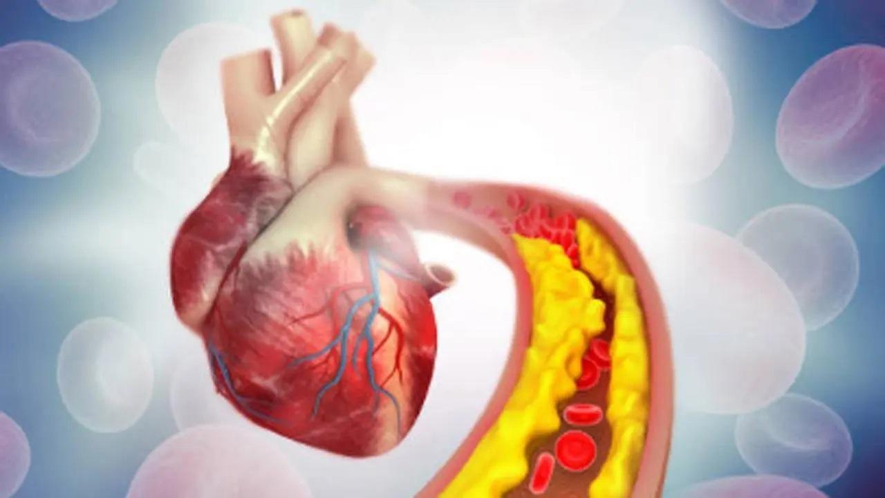 This cholesterol pill may fight high risk of heart attack