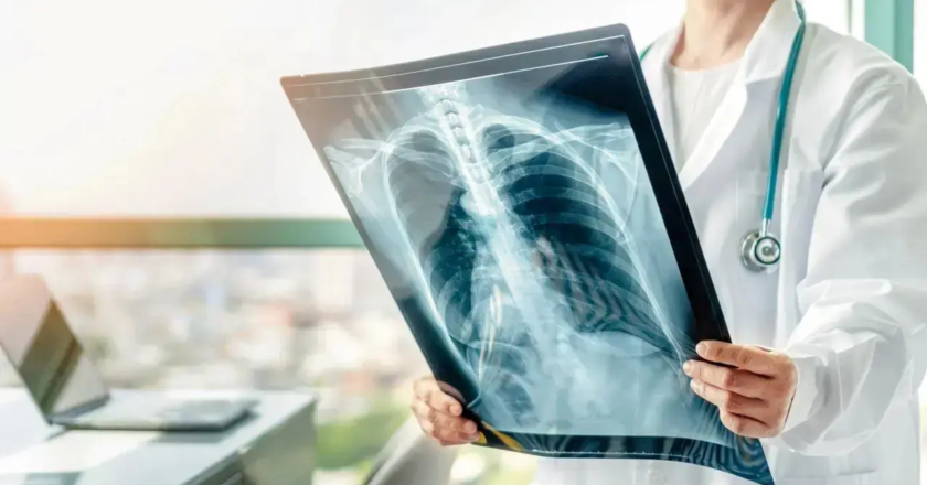 14 pc of Indians aged 45 and above could have obstructive lung disease: Study