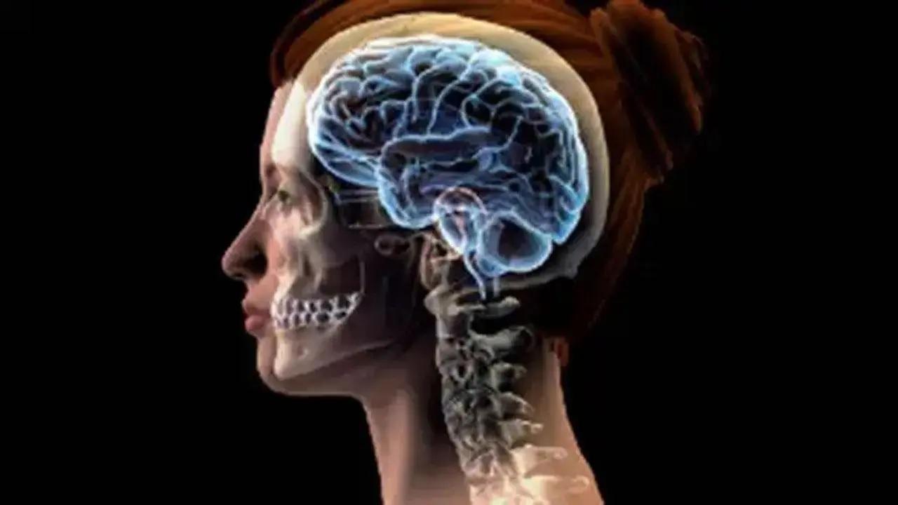 More than 1 in 3 people worldwide live with brain