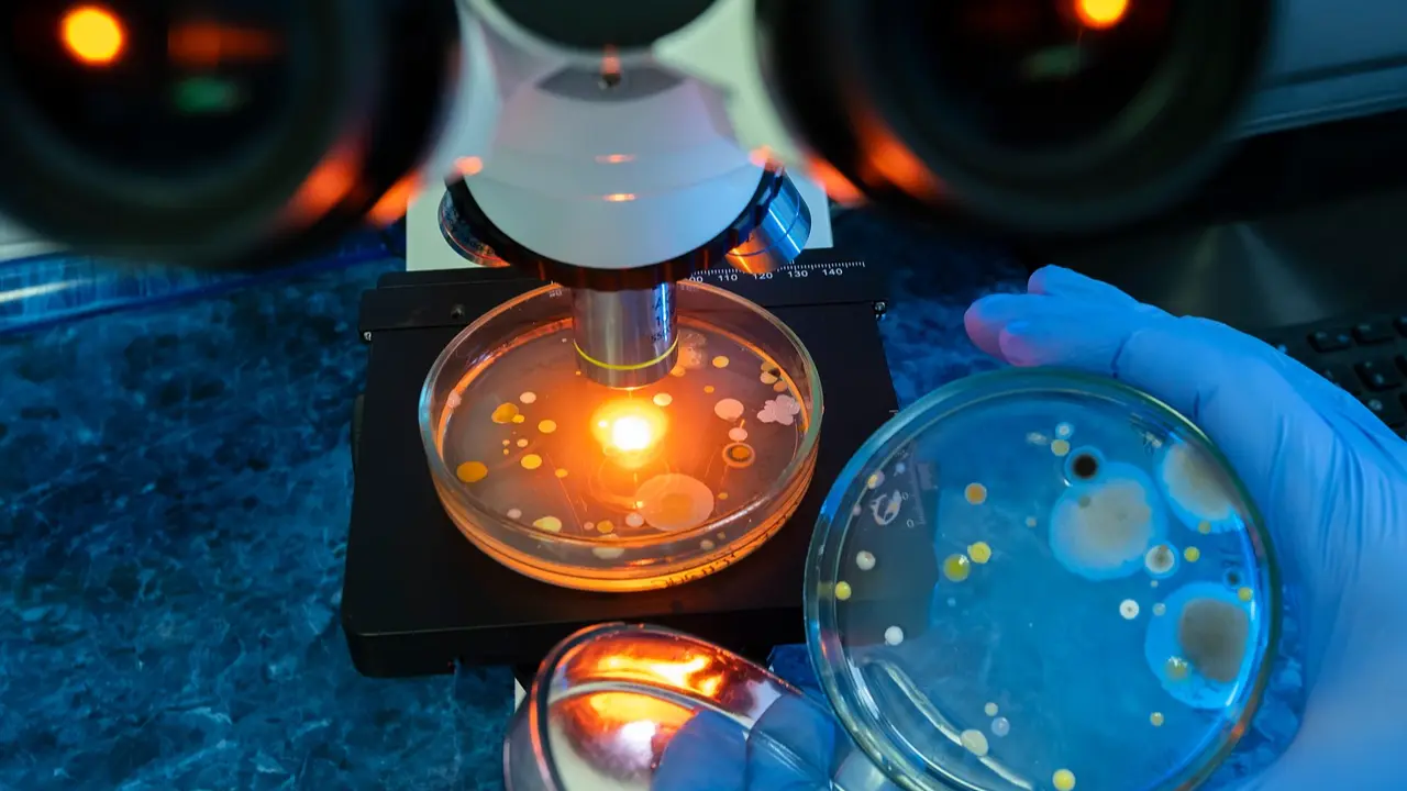 Amoebae from Mumbai creek harbour bacteria with high AMR risk