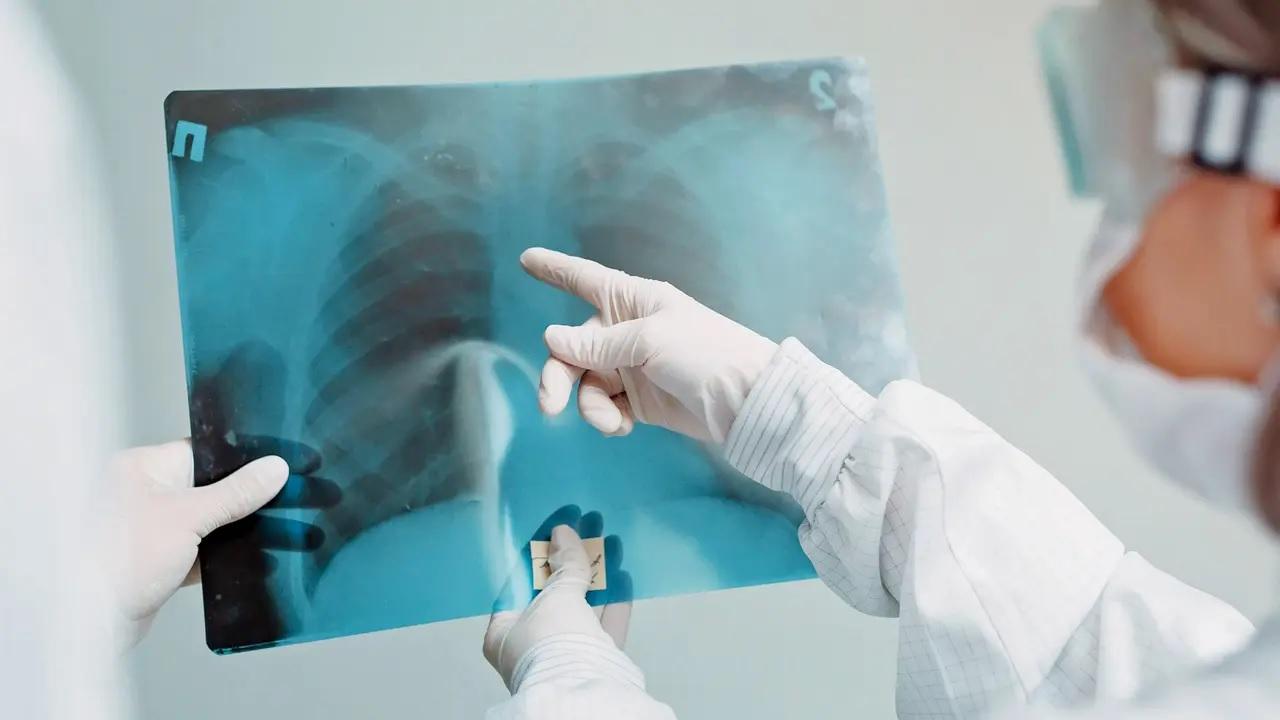 IIT Bombay study shows how TB bacteria shield themselves from