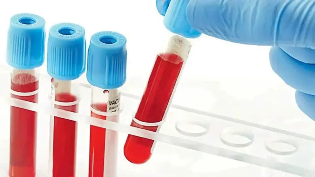 Health Ministry proposes to remove duplicate viral testing of blood products