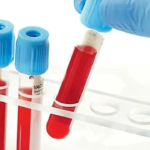 Health Ministry proposes to remove duplicate viral testing of blood products