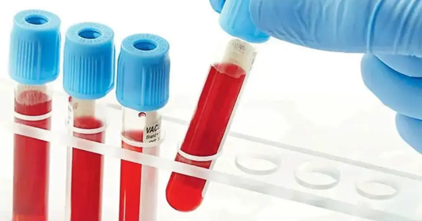 Health Ministry proposes to remove duplicate viral testing of blood products