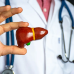 Hepatitis A may trigger acute liver failure in people with fatty liver: Doctors