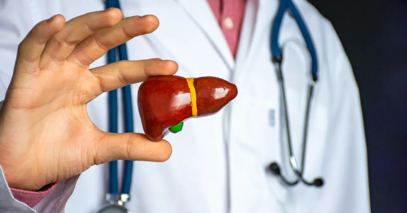 Hepatitis A may trigger acute liver failure in people with fatty liver: Doctors