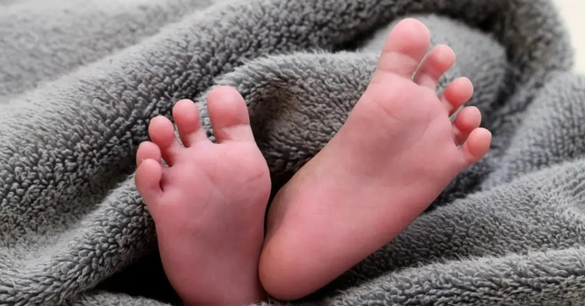Mumbai doctors remove tennis ball-sized brain tumour in three-month-old baby