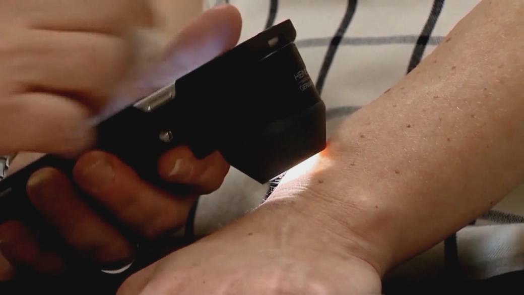 Click to play video: 'More than 11K Canadians will be diagnose with skin cancer in 2026'
