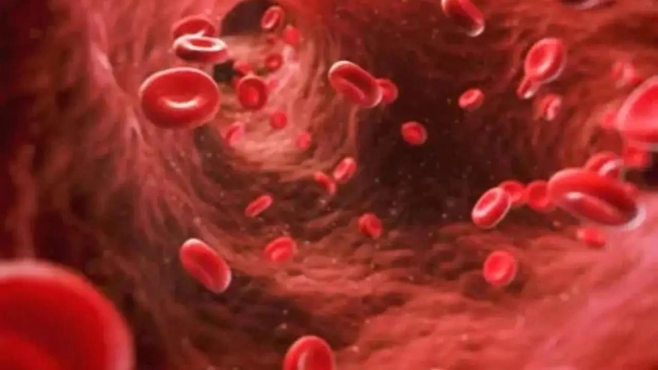 Hypertension emerging as one of the leading causes of stroke