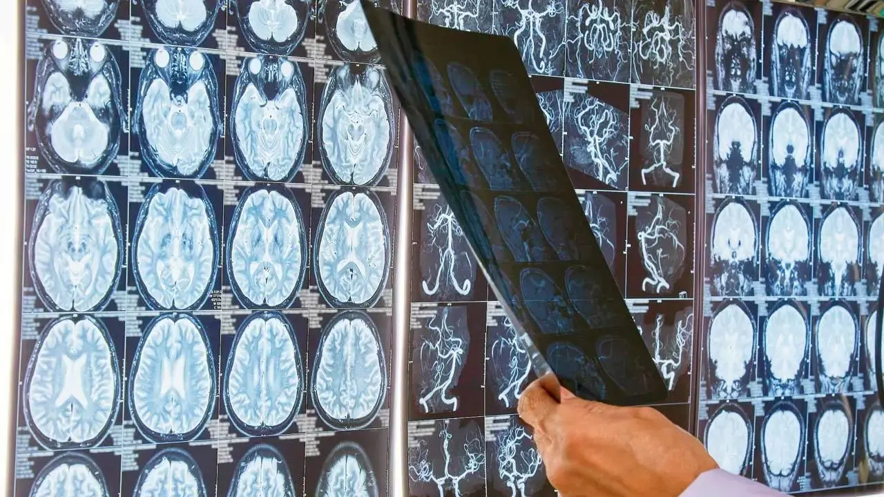 Dementia campaigns should include engaging personalised approaches Study