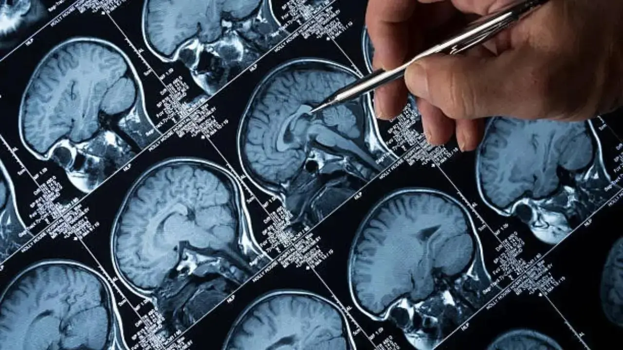 Mumbai doctor publishes study validating brain surgery to help treat Parkinson's 2 Mumbai doctor publishes study validating brain surgery to help treat