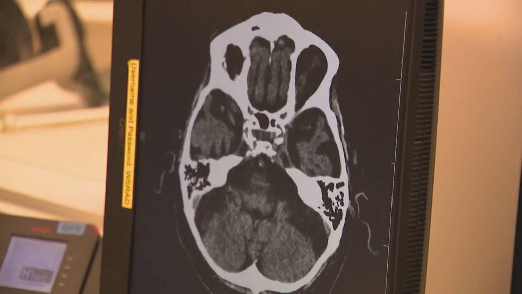 Click to play video: 'Possible brain tumour risk tied to some birth control, new study finds'