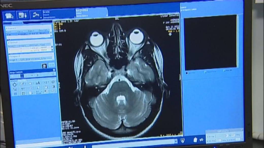 Click to play video: 'Raising Awareness on World Alzheimer’s Day'